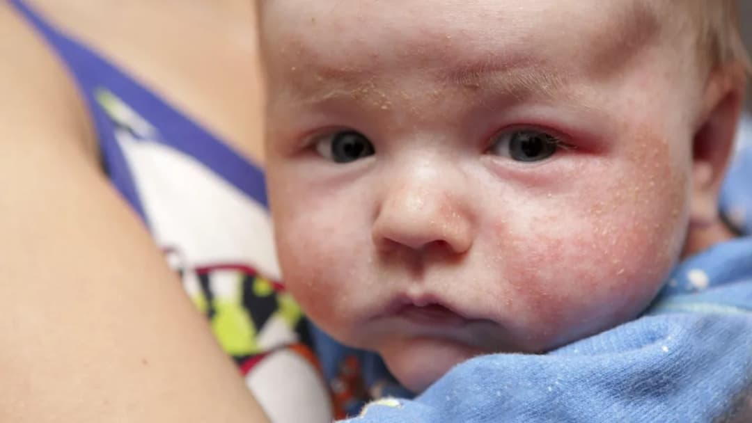 Nietolerancja pokarmowa u niemowląt: Objawy, które każdy rodzic musi znać