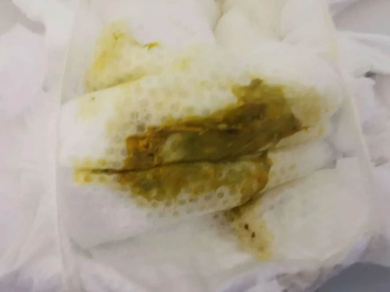 Jak wyglądają kupki przy ząbkowaniu? 7 ważnych informacji