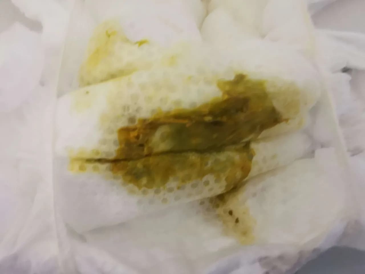 Jak wyglądają kupki przy ząbkowaniu? 7 ważnych informacji